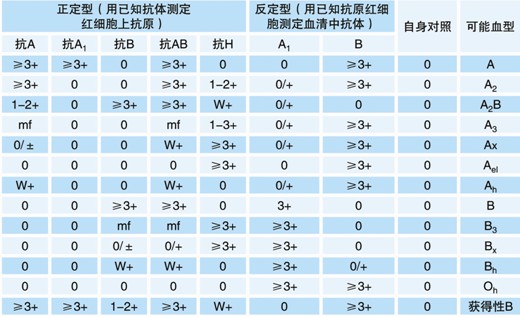 【試驗(yàn)?zāi)康暮驮怼? ABO血型鑒定是通過(guò)檢測(cè)被檢者紅細(xì)胞上是否存在A(yíng)和/或B抗原（正定型）以及被檢者血漿中是否存在抗A和/或抗B抗體（反定型）來(lái)確定。 對(duì)于成年個(gè)體被檢者，紅細(xì)胞上的A和/或B抗原與血漿中的抗A和/或抗B抗體存在一種對(duì)應(yīng)關(guān)系。其獨(dú)特性質(zhì)在于：紅細(xì)胞上缺乏A和/或B抗原，則血清中存在與所缺乏的抗原對(duì)應(yīng)的強(qiáng)反應(yīng)性抗體，如紅細(xì)胞上缺乏A抗原，則可以預(yù)見(jiàn)血漿中存在抗A抗體。 常規(guī)的ABO定型必須包括正定型（紅細(xì)胞定型）和反定型（血漿定型），并將正反定型結(jié)果相互驗(yàn)證，如果紅細(xì)胞發(fā)生凝集，預(yù)期其凝集強(qiáng)度≥2+；只有正反定型結(jié)果一致時(shí)才能準(zhǔn)確定型。 20121212104627668.jpg  然而，有時(shí)ABO正定型和反定型會(huì)出現(xiàn)結(jié)果不一致現(xiàn)象，或陽(yáng)性反應(yīng)強(qiáng)度弱于2+。引起正反定型結(jié)果不一致因素有： （一）正定型出現(xiàn)弱反應(yīng)或缺失抗原 1. A亞型、B亞型或AB亞型。 2. 白血病導(dǎo)致A或B抗原減弱。 3. 何杰金?。℉odgkin’s）有時(shí)會(huì)抑制抗原表達(dá)，與白血病類(lèi)似。 4. 由于某種疾?。ㄈ绺骨话⒁认侔?dǎo)致血漿中存在大量的型物質(zhì)，中和抗A或抗B抗體，引起正定型為假陰性或弱陽(yáng)性。需要將正定型的紅細(xì)胞用生理鹽水洗滌后再次定型可解決此問(wèn)題。 5. 骨髓移植 6. 非ABO同型輸血 （二）正定型紅細(xì)胞上多余的抗原反應(yīng) 1. 自身凝集紅細(xì)胞、抗體致敏紅細(xì)胞導(dǎo)致。 2. 細(xì)胞未洗滌，血漿蛋白引起的假陽(yáng)性反應(yīng)。 3. 細(xì)胞未洗滌，血漿中存在針對(duì)正定型試劑中某種成分的抗體導(dǎo)致。 4. 骨髓移植。 5. 獲得性B。 6. B（A）現(xiàn)象。 7. ABO非相合輸注。 （三）正定型出現(xiàn)混合視野反應(yīng) 1. 近期輸血。 2. 骨髓移植。 3. 異卵雙胞胎或雙受精卵產(chǎn)生的嵌合體。 4. 胎兒和母體出血。 5. A3亞型。 （四）反定型血清中出現(xiàn)弱反應(yīng)或反應(yīng)缺失 1. 年齡相關(guān)：新生兒以及小于6月齡的嬰兒以及老年人。 2. ABO亞型有亞型抗體，如A2、A2B型人的抗A1。 3. 低球蛋白血癥（如白血病人、使用免疫抑制劑患者、免疫缺陷患者）。 4. 移植患者使用抗排異藥物。 5. 雙胞胎或雙受精卵產(chǎn)生的嵌合體。 （五）反定型出現(xiàn)多余的抗體反應(yīng) 1. 冷自身抗體。 2. 特異性冷同種抗體。 3. 血清中存在針對(duì)試劑紅細(xì)胞保存液成分的抗體。 4. 某些疾病導(dǎo)致球蛋白水平增高（多發(fā)性骨髓瘤、巨球蛋白血癥、Hodgkin’s 淋巴瘤）引起緡錢(qián)狀凝集。 5. 輸用大分子血漿擴(kuò)容劑。 6. 非ABO同型的移植。 7. 靜脈注射免疫球蛋白。 （六）技術(shù)方面的錯(cuò)誤 1. 血液樣本被污染，如混入其他人樣本。 2. 被檢紅細(xì)胞的濃度過(guò)高或過(guò)低。 3. 忘記在反應(yīng)體系中加入檢測(cè)樣本或試劑。 4. 未按照試劑使用說(shuō)明進(jìn)行試驗(yàn)。 5. 離心步驟離心時(shí)間不足或離心時(shí)間超時(shí)。 6. 對(duì)試驗(yàn)結(jié)果記錄或判讀不正確。 為了解決ABO亞型引起的ABO正反定型不一致以及正定型紅細(xì)胞上抗原產(chǎn)生弱反應(yīng)或抗原反應(yīng)性缺失，可以使用ABO亞型定型卡來(lái)輔助血型鑒定。 ABO亞型定型卡系采用凝膠作為微柱凝膠卡的填充物，將生物化學(xué)的凝膠分子篩過(guò)濾技術(shù)、離心技術(shù)和血型血清學(xué)的抗體特異性結(jié)合在一起。每卡有八個(gè)凝膠管，其中抗A凝膠管灌注了含抗A抗體的凝膠；抗A1凝膠管灌注了含抗A1抗 體的凝膠；抗B凝膠管灌注了含抗B抗體的凝膠；抗AB凝膠管灌注了含抗AB抗體的凝膠；抗H凝膠管灌注了含抗H抗體的凝膠；A細(xì)胞、B細(xì)胞及Ctl管中灌 注了不含血型抗體的凝膠，A細(xì)胞、B細(xì)胞用于檢測(cè)血漿中的抗體，Ctl管用于自身對(duì)照。當(dāng)抗原抗體反應(yīng)時(shí)，凝集的紅細(xì)胞在離心力的作用下不能通過(guò)凝膠而留 在凝膠上層或游離在凝膠中，呈現(xiàn)陽(yáng)性反應(yīng)；而抗原抗體沒(méi)有反應(yīng)時(shí)，未凝集的紅細(xì)胞在離心力的作用下可通過(guò)凝膠而沉積在微柱凝膠管的底部，呈現(xiàn)陰性反應(yīng)。 【ABO亞型定型卡的用途】 鑒定紅細(xì)胞上的ABO抗原，解決亞型引起ABO正反定型不一致、以及正定型紅細(xì)胞上抗原產(chǎn)生弱反應(yīng)或抗原反應(yīng)性缺失的問(wèn)題。 【樣本要求】 1. 建議使用抗凝的血樣，尤其是EDTA抗凝管采集的血樣，需要量2ml。（EDTA抗凝采血管為紫帽管）。 2. 血液樣本在采集后48小時(shí)以?xún)?nèi)檢測(cè)。 【所需儀器設(shè)備及耗材】 1. ABO亞型定型卡 2. 血型血清學(xué)離心機(jī)（用于離心分離血漿、洗滌紅細(xì)胞） 3. 微柱凝膠卡離心機(jī) 4. 微量移液槍及吸頭 【試驗(yàn)操作】  一、被檢血液樣本的處理 1. EDTA抗凝的血液樣本離心3000rpm 1分鐘，將上清血漿轉(zhuǎn)入一支12×75mm試管中備用，得到壓積紅細(xì)胞。 2. 另取一支12×75mm試管中，加入0.1ml上述步驟1中的壓積紅細(xì)胞 ，用生理鹽水洗滌一次，棄上清，得到壓積紅細(xì)胞。 3. 在一支12×75mm 試管中，加入1ml生理鹽水（或LISS液），加入步驟2中得到的壓積紅細(xì)胞10μl，混勻得到0.8~1%的被檢紅細(xì)胞懸液。 二、 紅細(xì)胞定型 1. 取ABO亞型定型卡一片，注意檢查外觀(guān)，確保凝膠管的凝膠上層存在液面，凝膠不會(huì)干枯。將符合要求的卡進(jìn)行標(biāo)記，按照試驗(yàn)需要撕開(kāi)封口膜。 2. 用微量移液槍分別向每孔樣品槽中沿樣品槽內(nèi)壁呈45°角緩慢加入50μl 0.8~1%的被檢者紅細(xì)胞懸液。 3. 在臺(tái)面交替輕叩卡左下角和右下角，確保所加入的液體在卡的樣品槽中呈水平狀態(tài)，而不是偏向一側(cè)。 4. 將卡放入微柱凝膠卡離心機(jī)離心，LB-3000低速離心機(jī)第一檔離心900rpm 2分鐘，再1500rpm 3分鐘，判讀結(jié)果并記錄。 【結(jié)果判讀及解釋】 1. 反應(yīng)陰、陽(yáng)性的判讀 20121212104658937.jpg 2. 陰陽(yáng)性結(jié)果解釋 (1) 陽(yáng)性結(jié)果：紅細(xì)胞浮在凝膠表面或膠中，為陽(yáng)性反應(yīng)。 (2) 陰性結(jié)果：紅細(xì)胞全部沉于微柱凝膠的底部。 (3) 血型亞型鑒定需要根據(jù)正反定型結(jié)果來(lái)判定，結(jié)果判定可參考下表。 20121212104720212.jpg 注：mf=混合視野，w=弱反應(yīng)。 【注意事項(xiàng)】 1. 建議在使用凝膠卡前先離心再應(yīng)用。 2. 若凝膠卡封口開(kāi)裂、孔中凝膠干涸或有氣泡，不可使用。 3. 撕開(kāi)凝膠卡封口膜時(shí)，不能用力過(guò)猛，以免造成凝膠微孔間的交叉污染。 4. 樣本采集后應(yīng)盡快檢測(cè)，若試驗(yàn)需要延遲，應(yīng)將樣本置2~8℃下短期儲(chǔ)存。 5. 紅細(xì)胞懸液的濃度為0.8~1%，濃度過(guò)高或過(guò)低會(huì)影響檢測(cè)結(jié)果。 6. 溶血、脂血、細(xì)菌污染等情況的標(biāo)本會(huì)影響檢測(cè)結(jié)果。 7. 血漿或血清標(biāo)本須充分離心去除纖維蛋白，否則會(huì)阻止紅細(xì)胞在微柱凝膠中的沉降，出現(xiàn)假陽(yáng)性。 8. 在Ctl孔（自身陰性對(duì)照）結(jié)果為陽(yáng)性時(shí)，試驗(yàn)結(jié)果無(wú)效。可能原因是由于被檢紅細(xì)胞已經(jīng)致敏IgM抗體導(dǎo)致自發(fā)凝集，此時(shí)可以用DTT將已經(jīng)致敏到紅細(xì)胞上的IgM抗體破壞后再行試驗(yàn)。 9. 人源血液樣本存在潛在的傳染性，凝膠卡使用后按醫(yī)療生物垃圾處理。